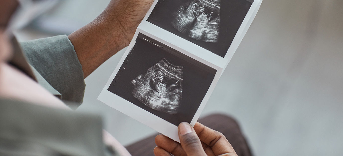 Ultrasound-banner1