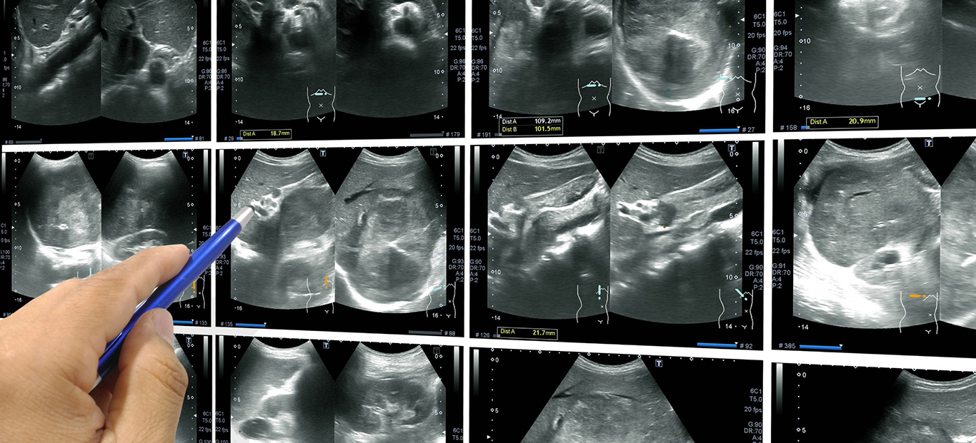 Ultrasound-banner2